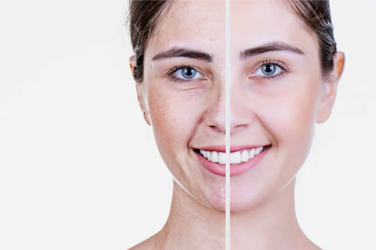 prima e dopo antiaging